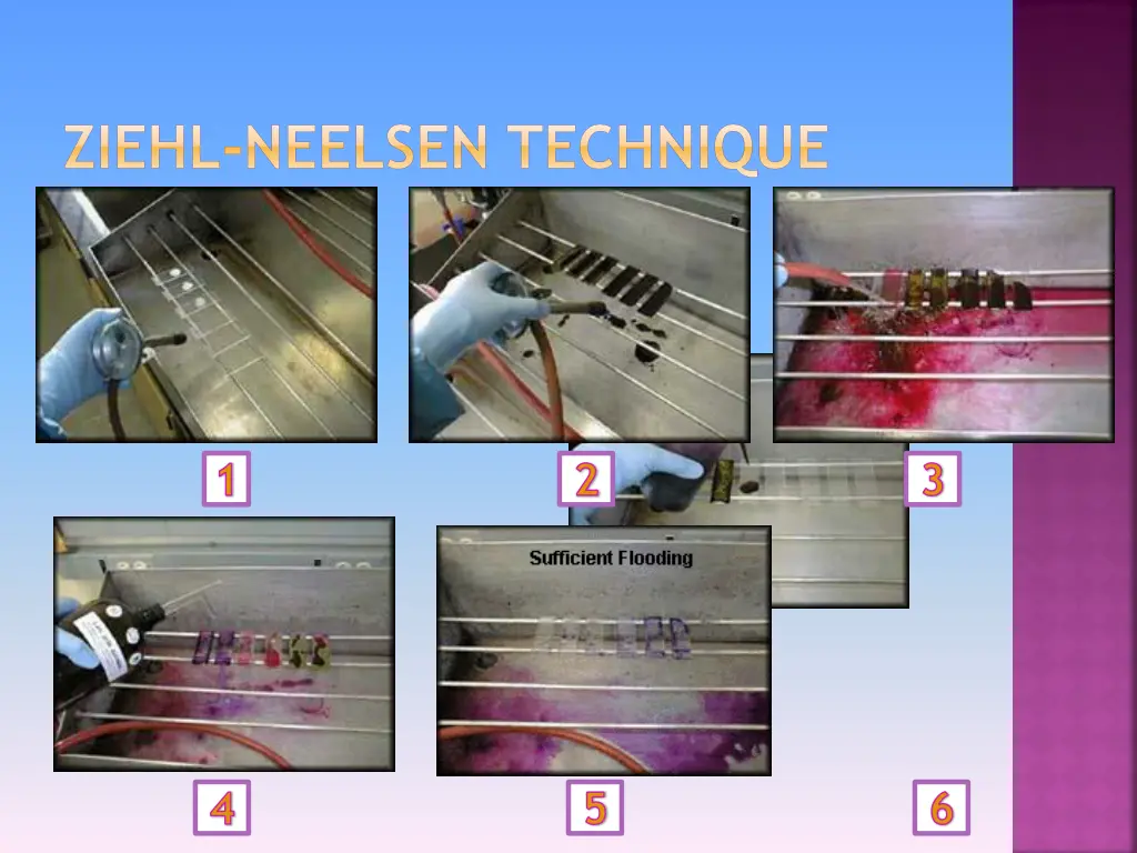 ziehl neelsen technique 2