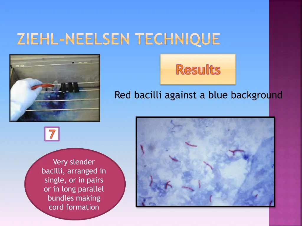 ziehl neelsen technique 3