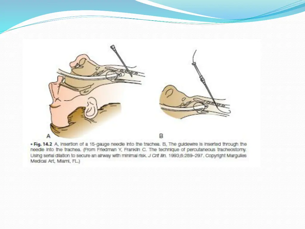 slide14
