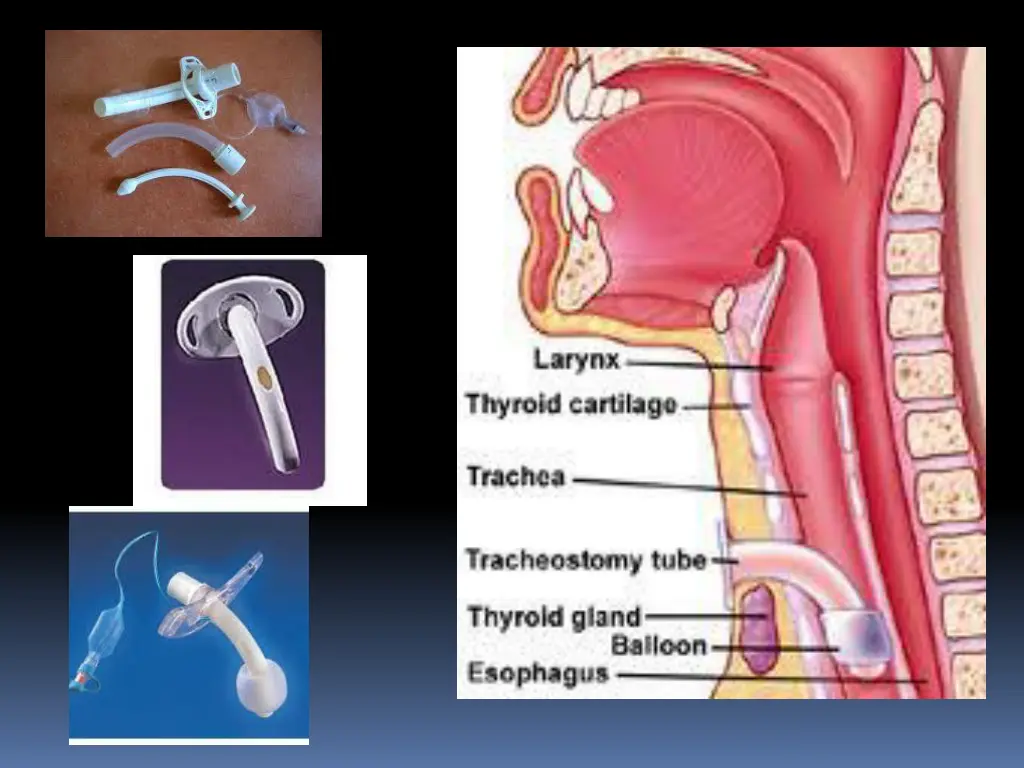 slide6