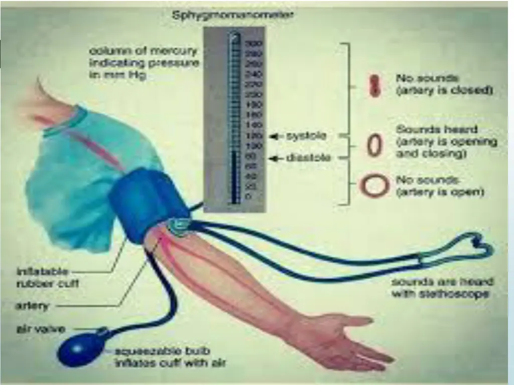 slide14