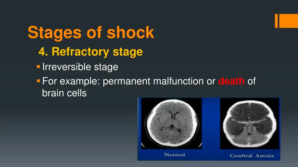stages of shock 4 refractory stage irreversible