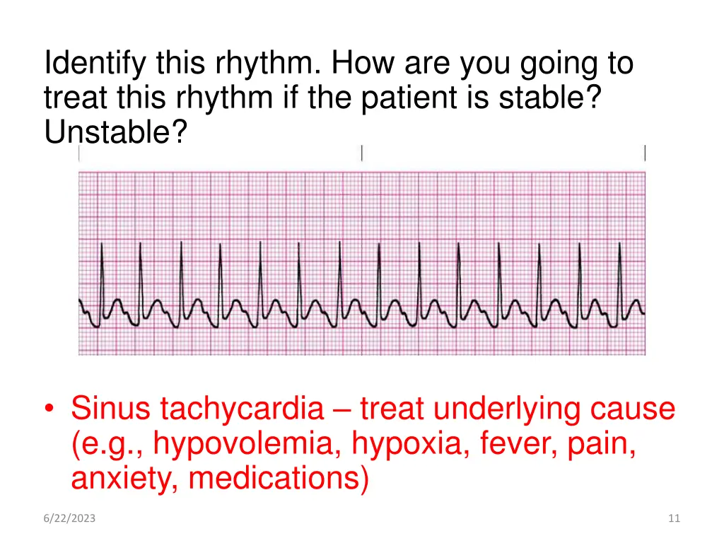 identify this rhythm how are you going to treat