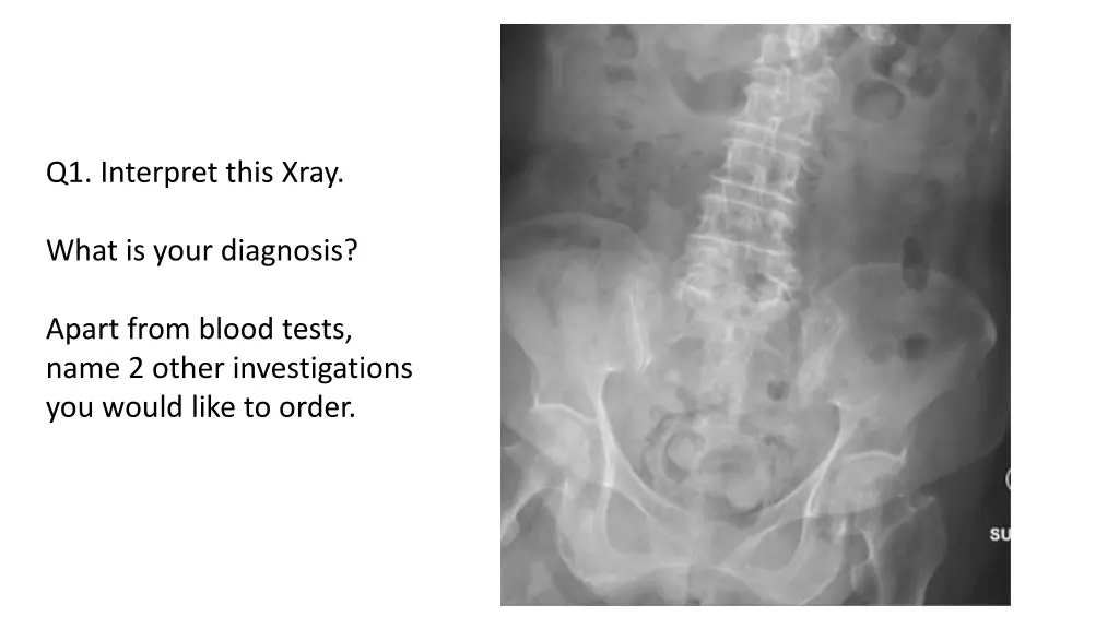 q1 interpret this xray