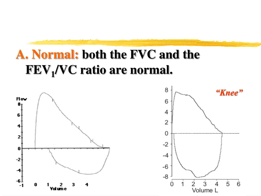 a normal both the fvc and the fev 1 vc ratio
