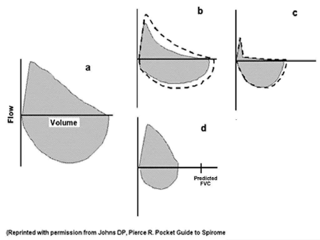 slide47