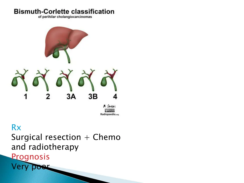 rx surgical resection chemo and radiotherapy