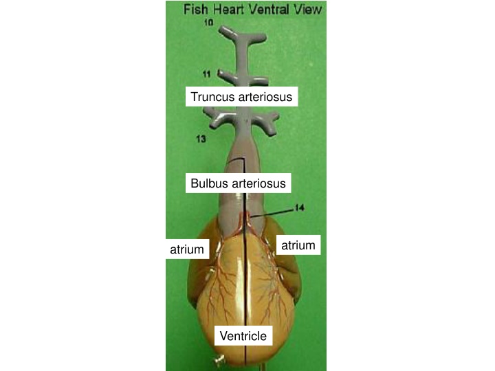 truncus arteriosus