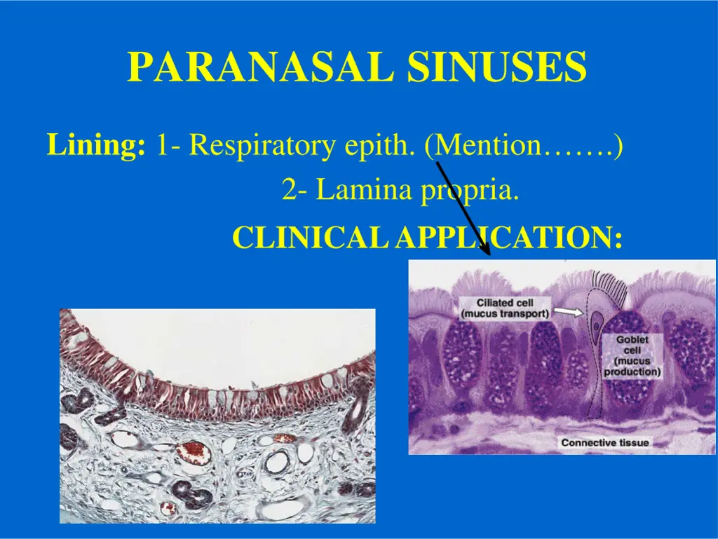 paranasal sinuses