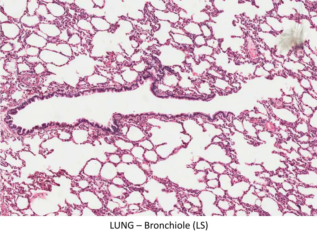 lung bronchiole ls