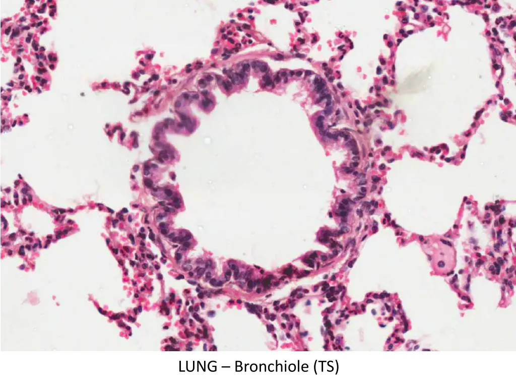 lung bronchiole ts