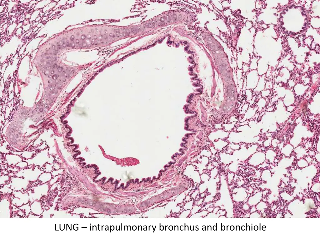 lung intrapulmonary bronchus and bronchiole