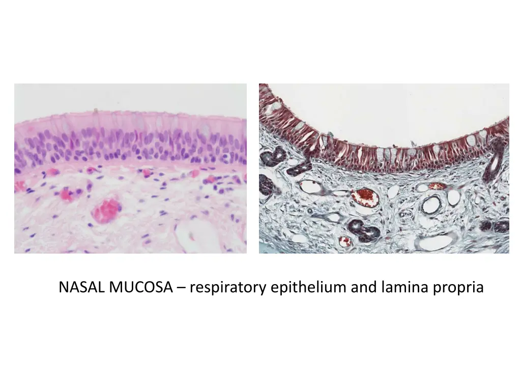 nasal mucosa respiratory epithelium and lamina