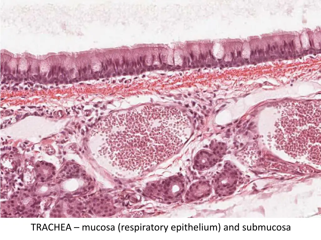trachea mucosa respiratory epithelium