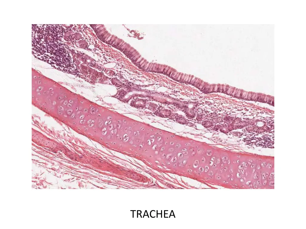trachea