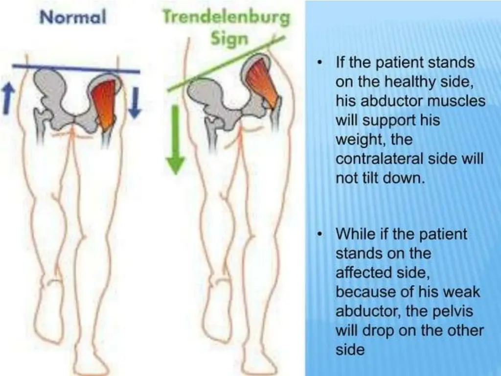 slide18