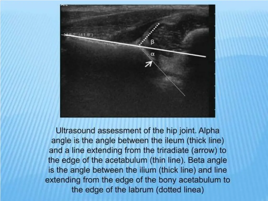 slide22