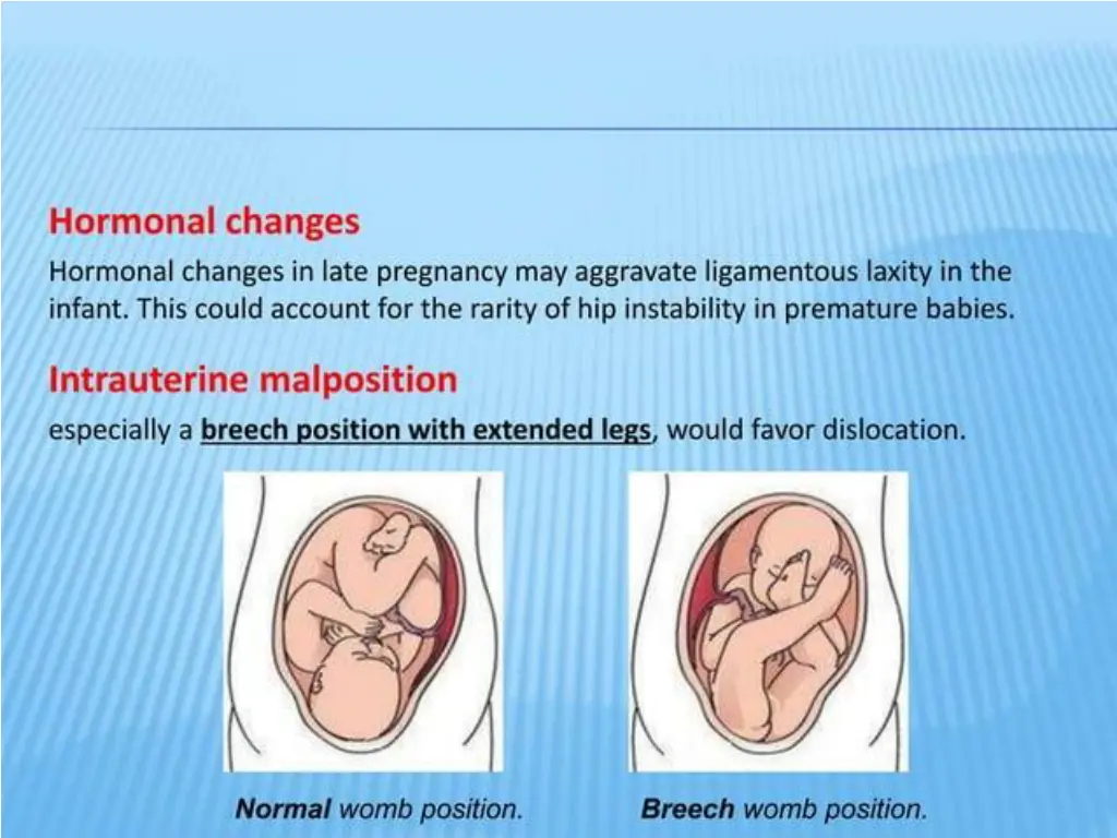 slide7