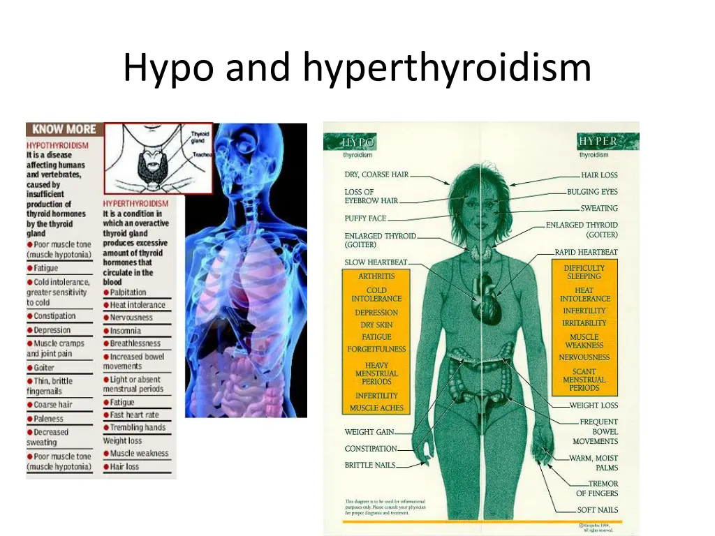hypo and hyperthyroidism