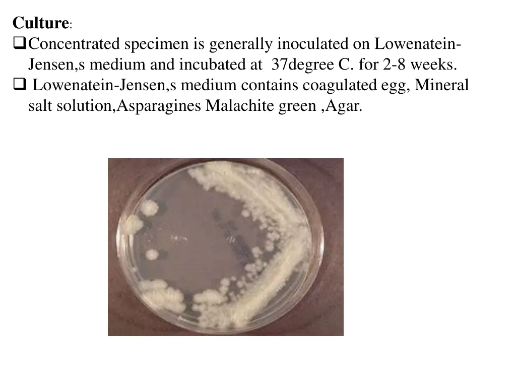 culture concentrated specimen is generally