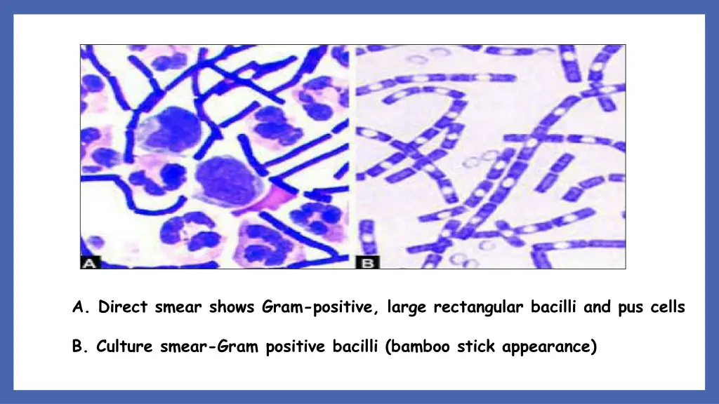 a direct smear shows gram positive large