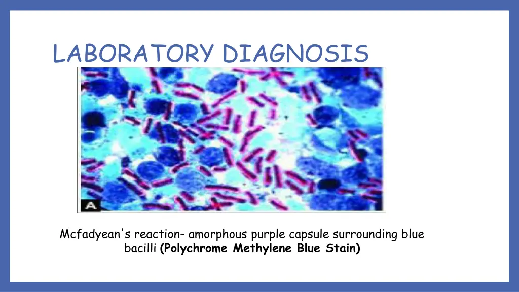 laboratory diagnosis 2