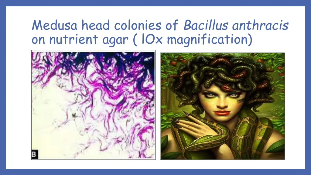 medusa head colonies of bacillus anthracis