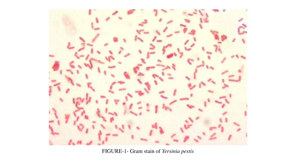 figure 1 gram stain of yersinia pestis