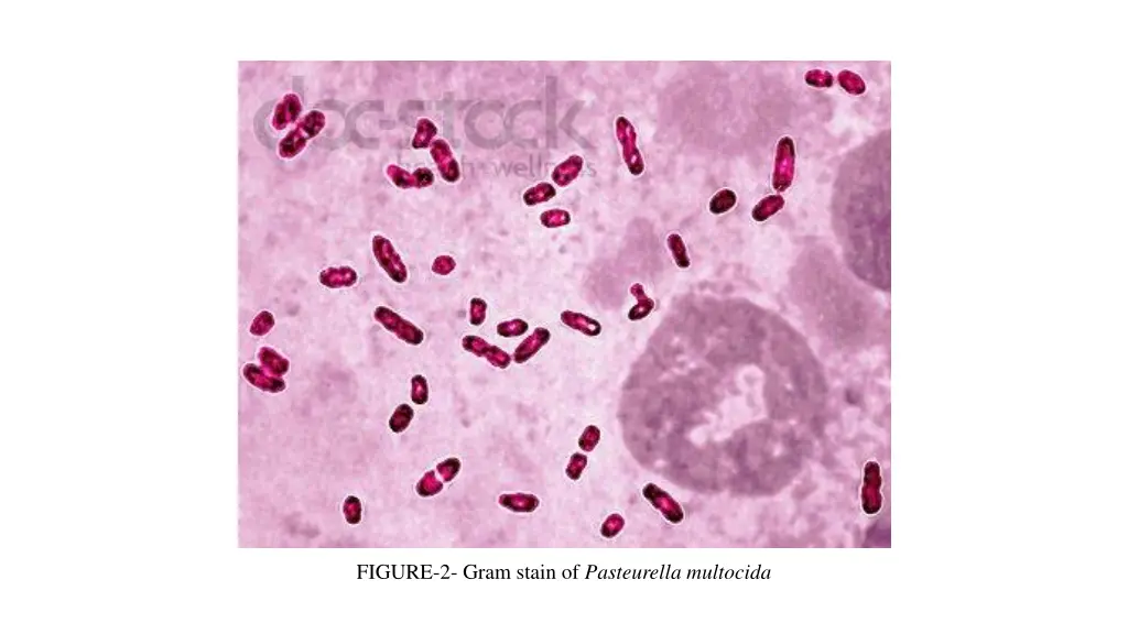 figure 2 gram stain of pasteurella multocida
