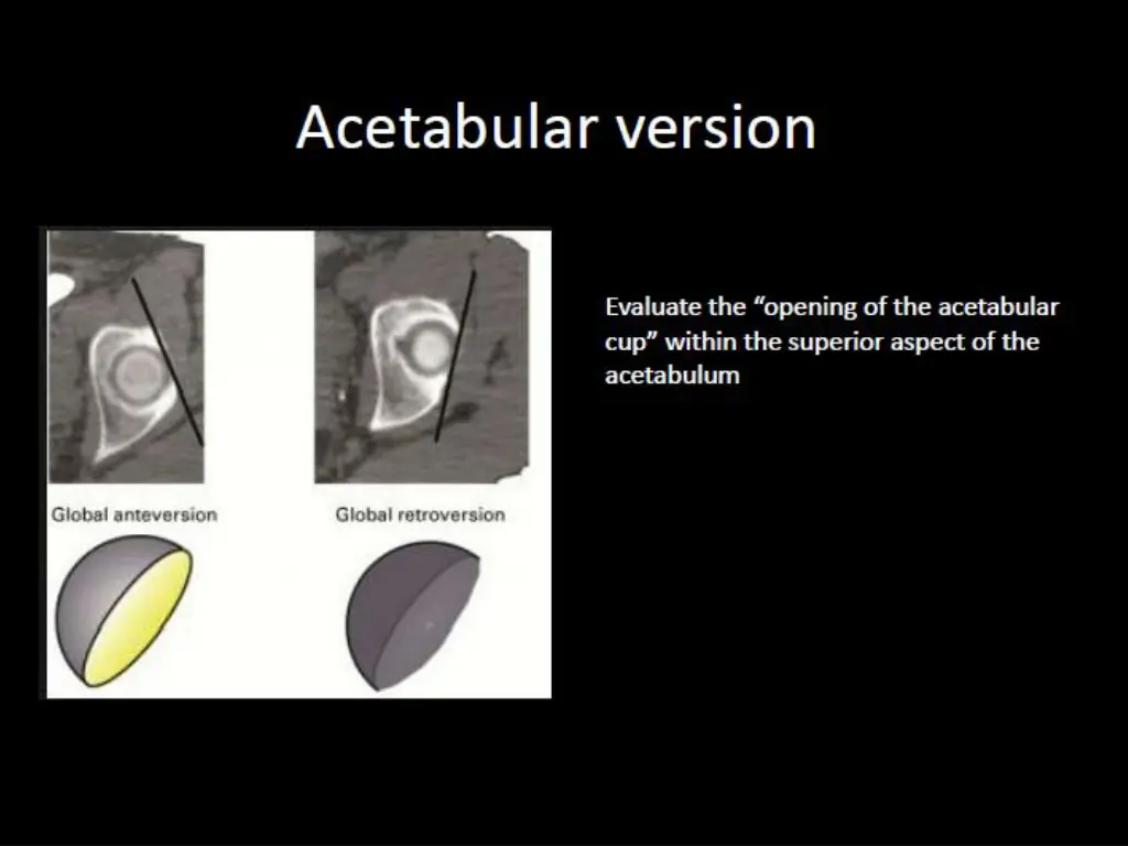 slide7