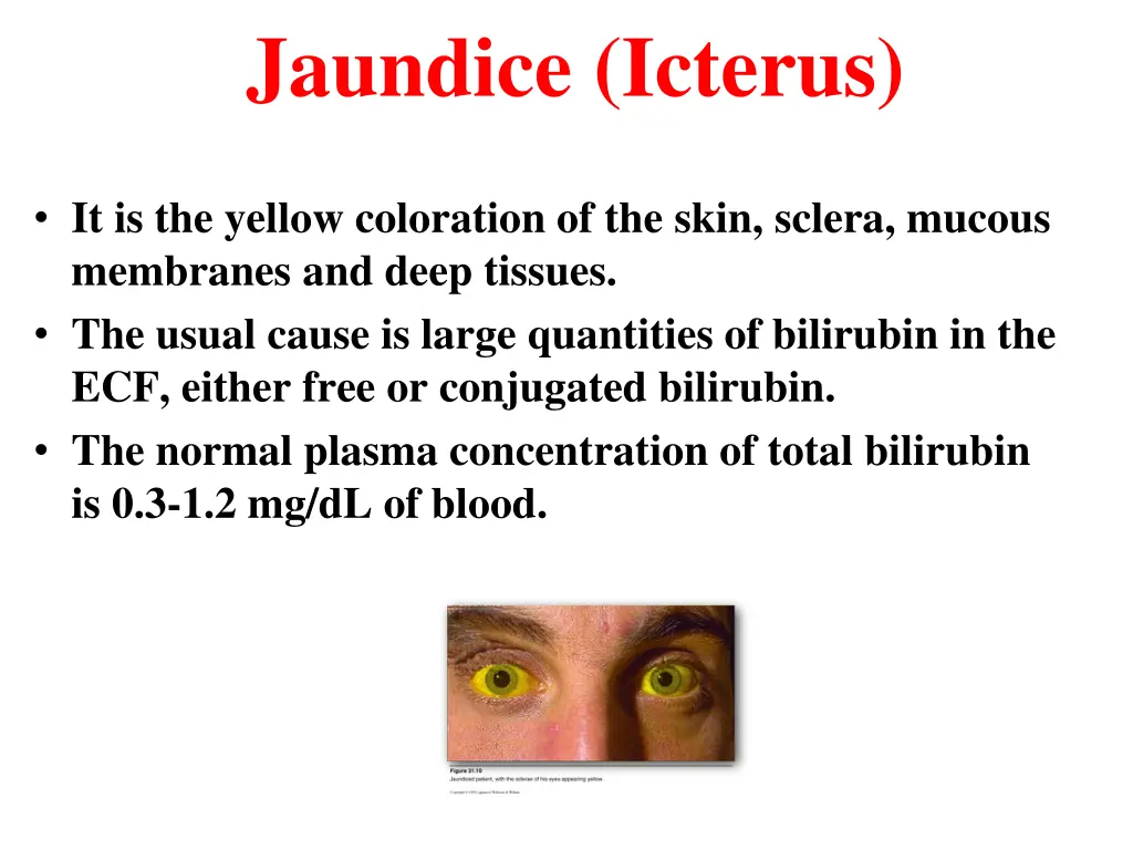 jaundice icterus