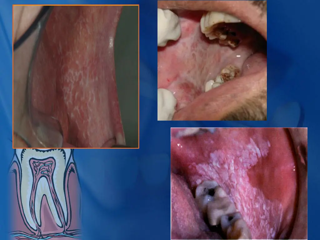 slide22