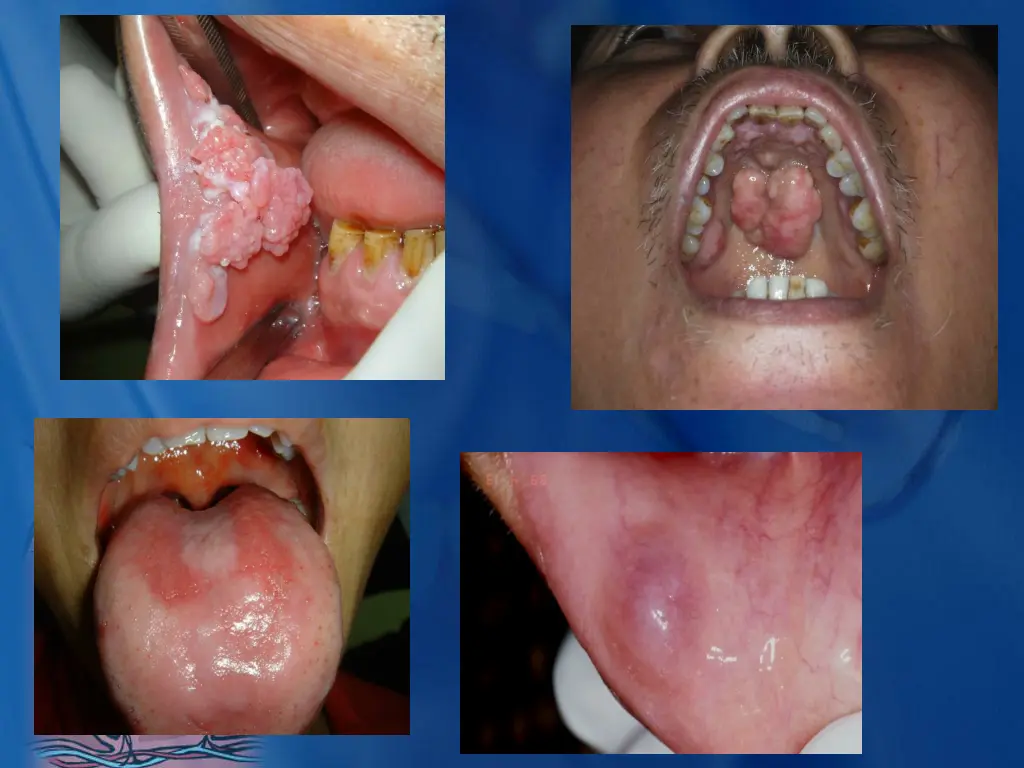 slide23