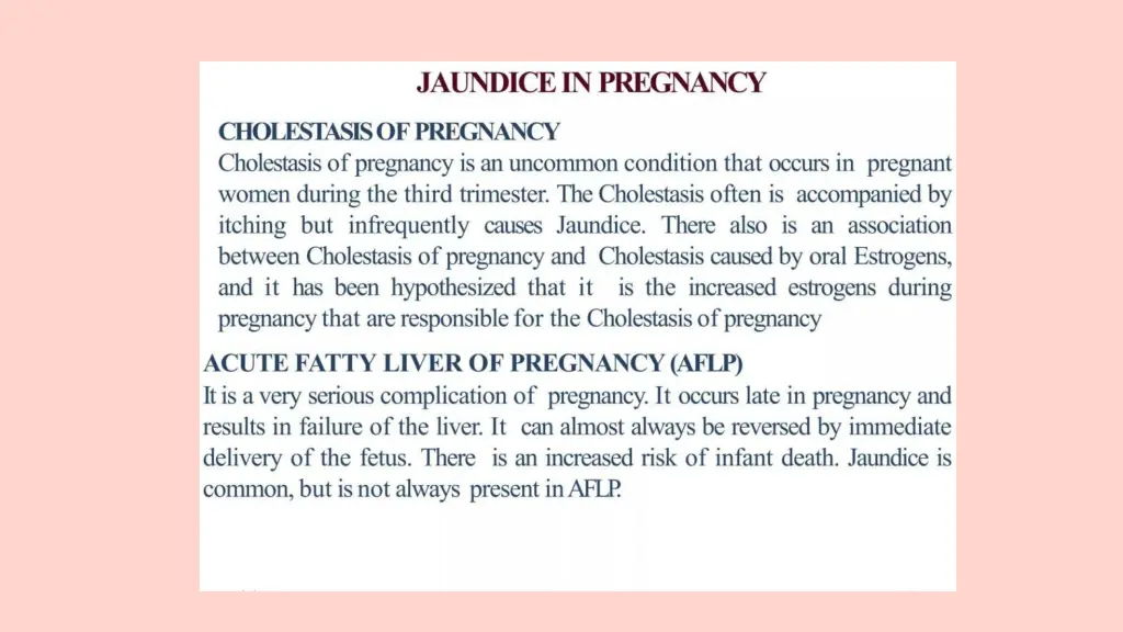 slide15