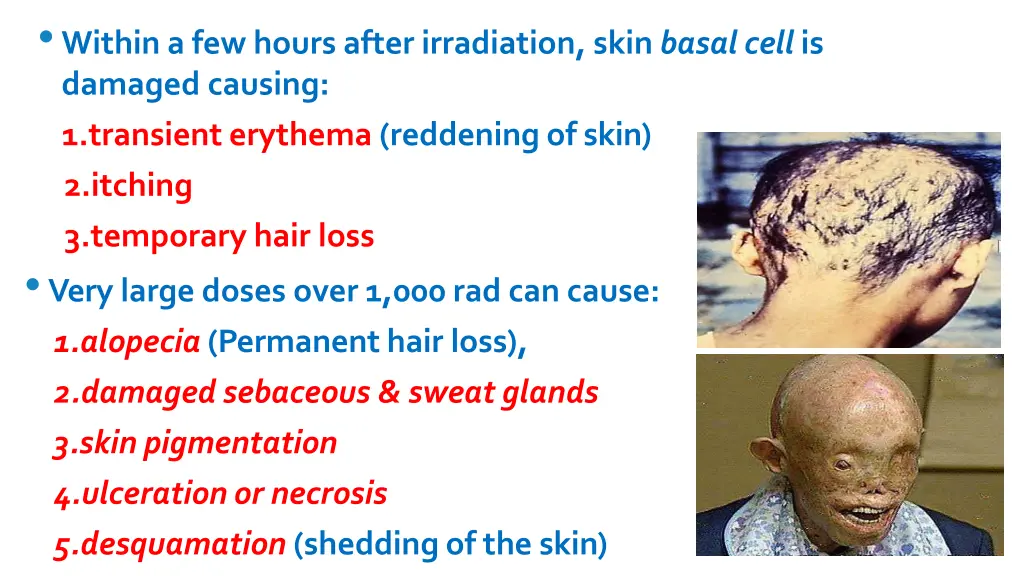 within a few hours after irradiation skin basal