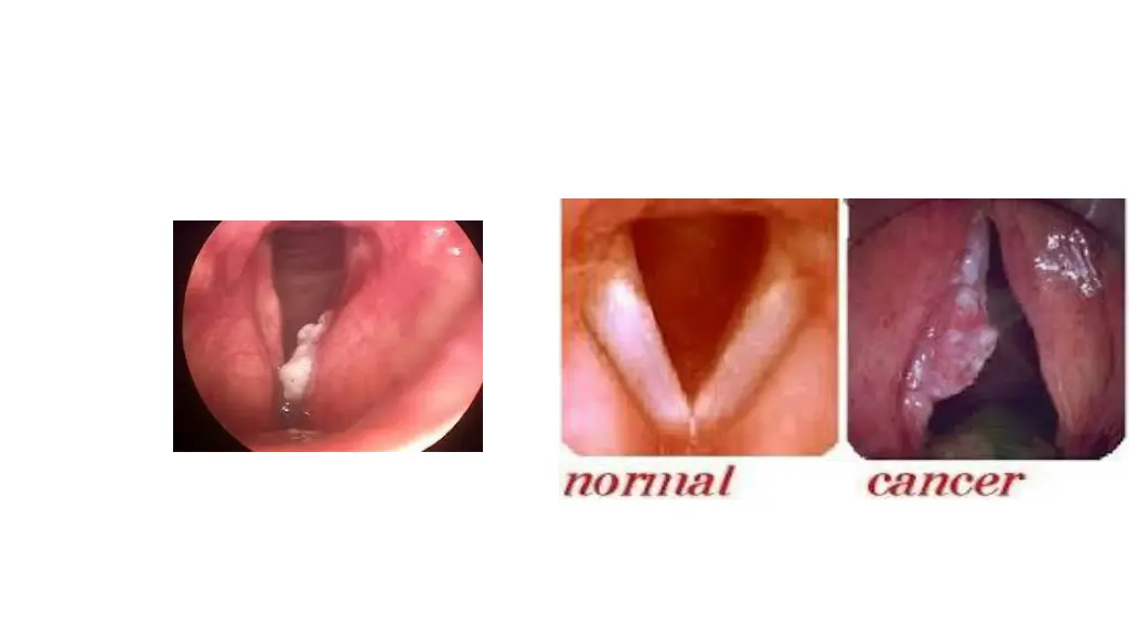 slide10