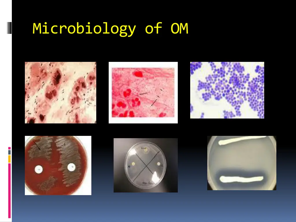 microbiology of om