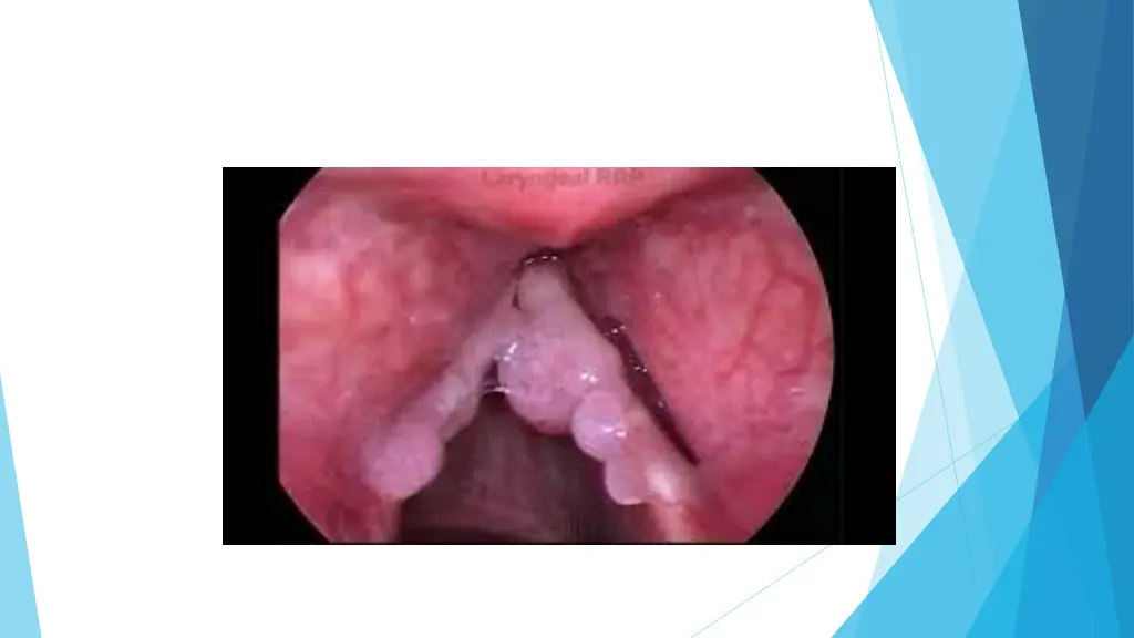 slide18