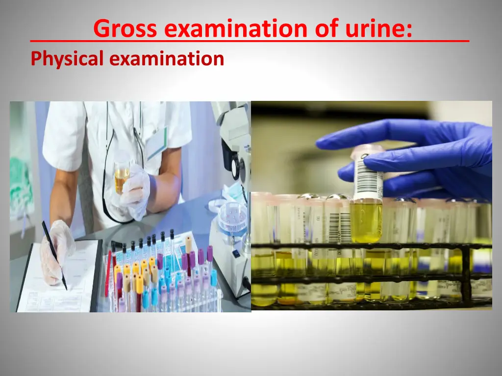 gross examination of urine physical examination
