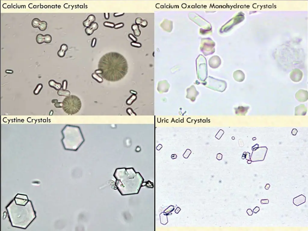 slide15