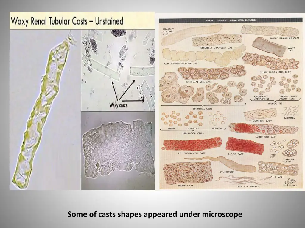 some of casts shapes appeared under microscope