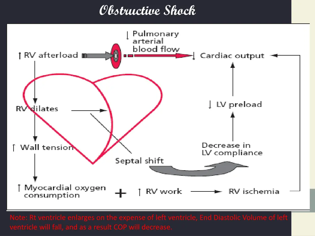 obstructive shock 1