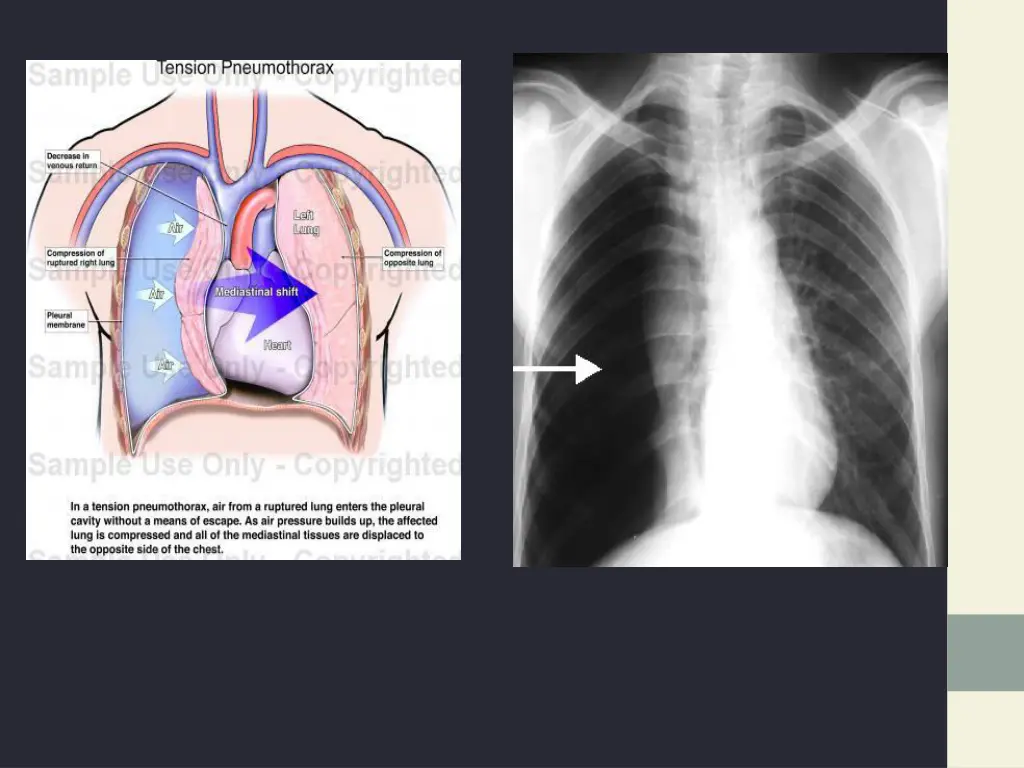 slide30