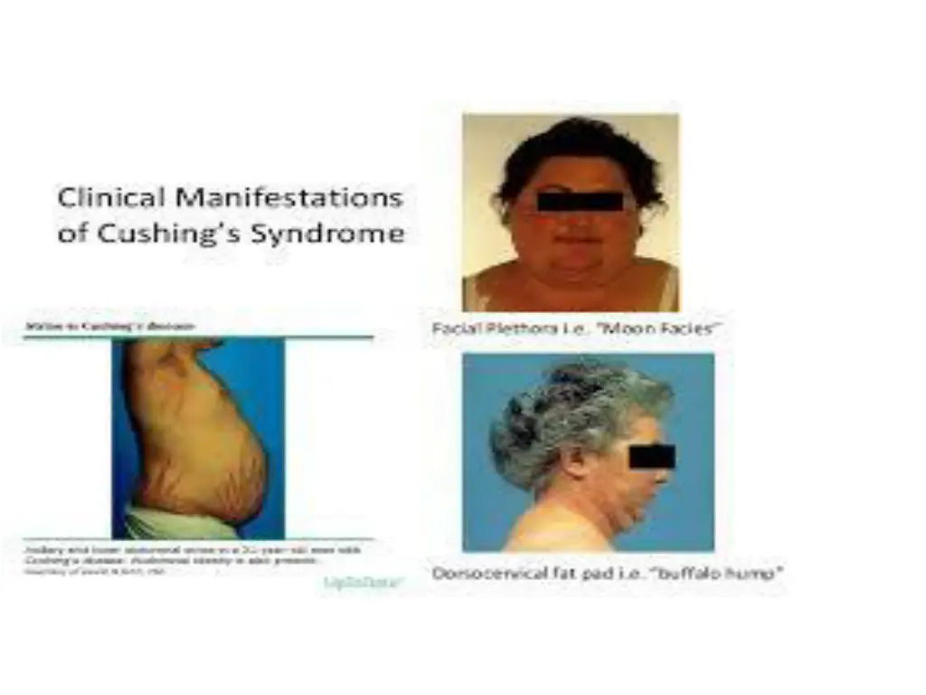 slide24