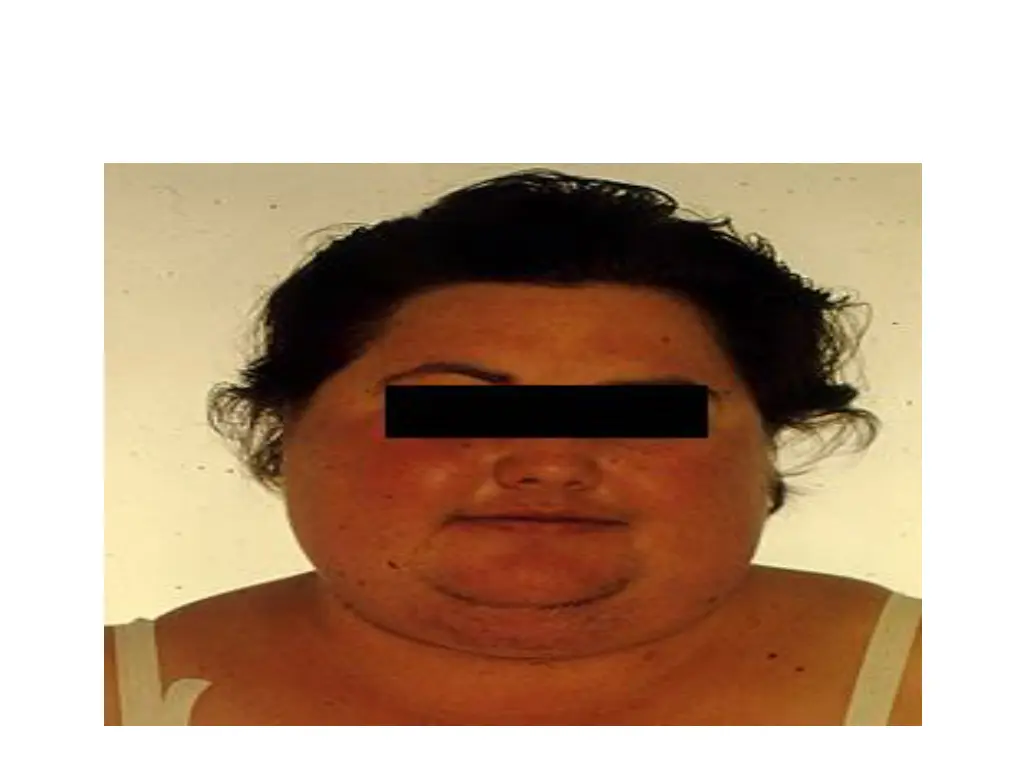 slide25
