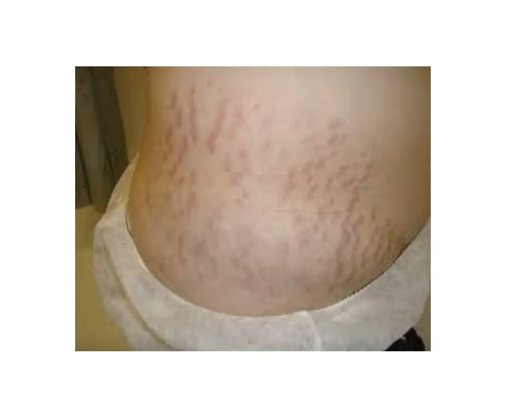slide26