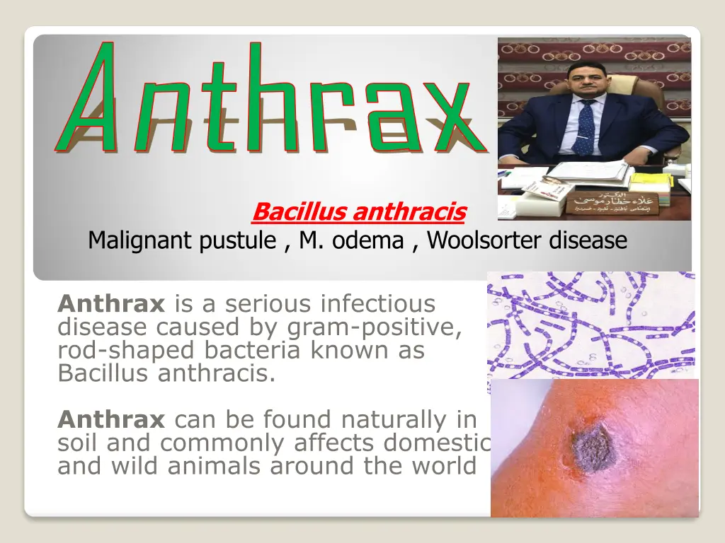 anthrax