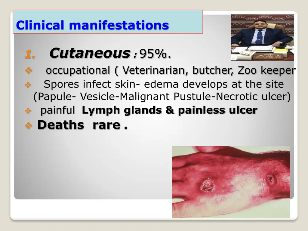 clinical manifestations 1
