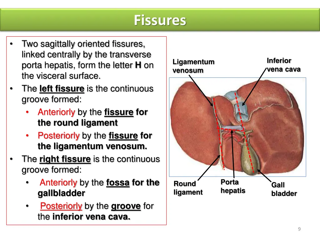 fissures