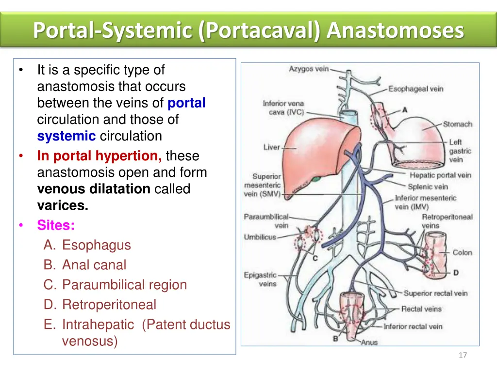 portal systemic portacaval anastomoses